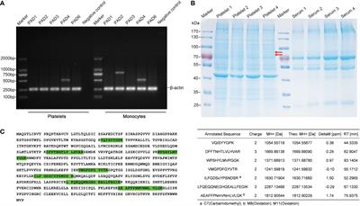 Platelets derived citrullinated proteins and microparticles are potential autoantibodies ACPA targets in RA patients